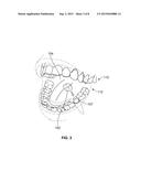 DENTAL DEVICES AND METHODS FOR TREATING ONE OR MORE TEETH diagram and image