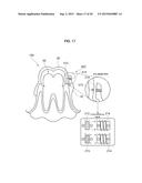 CORRECTION DEVICE diagram and image