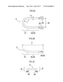 JAW REPOSITIONING APPLIANCE diagram and image