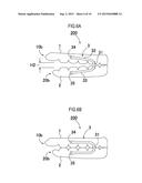 JAW REPOSITIONING APPLIANCE diagram and image