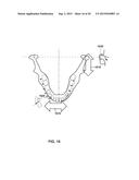 SYSTEM AND METHOD FOR MANUFACTURING LAYERED DENTURES diagram and image