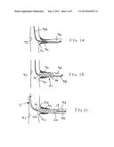 BALLOON CATHETERS AND METHODS FOR USE diagram and image