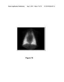 Labelled adrenomedullin derivatives and their use for imaging and therapy. diagram and image