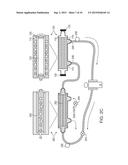 CARTRIDGE AND METHOD FOR INCREASING MYOCARDIAL FUNCTION diagram and image