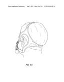 INTERFACE COMPRISING A NASAL SEALING PORTION AND A ROLLING HINGE diagram and image