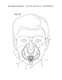 INTERFACE COMPRISING A NASAL SEALING PORTION AND A ROLLING HINGE diagram and image