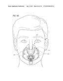 INTERFACE COMPRISING A NASAL SEALING PORTION AND A ROLLING HINGE diagram and image