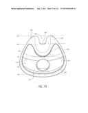 INTERFACE COMPRISING A NASAL SEALING PORTION AND A ROLLING HINGE diagram and image