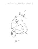 INTERFACE COMPRISING A NASAL SEALING PORTION AND A ROLLING HINGE diagram and image