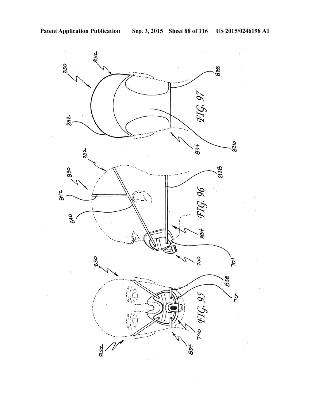 INTERFACE COMPRISING A NASAL SEALING PORTION AND A ROLLING HINGE - diagram, schematic, and image 89