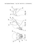 INTERFACE COMPRISING A NASAL SEALING PORTION AND A ROLLING HINGE diagram and image