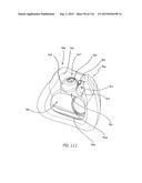 INTERFACE COMPRISING A NASAL SEALING PORTION AND A ROLLING HINGE diagram and image