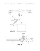 SYSTEM AND METHOD FOR OPTOGENETIC THERAPY diagram and image