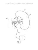 SYSTEM AND METHOD FOR OPTOGENETIC THERAPY diagram and image