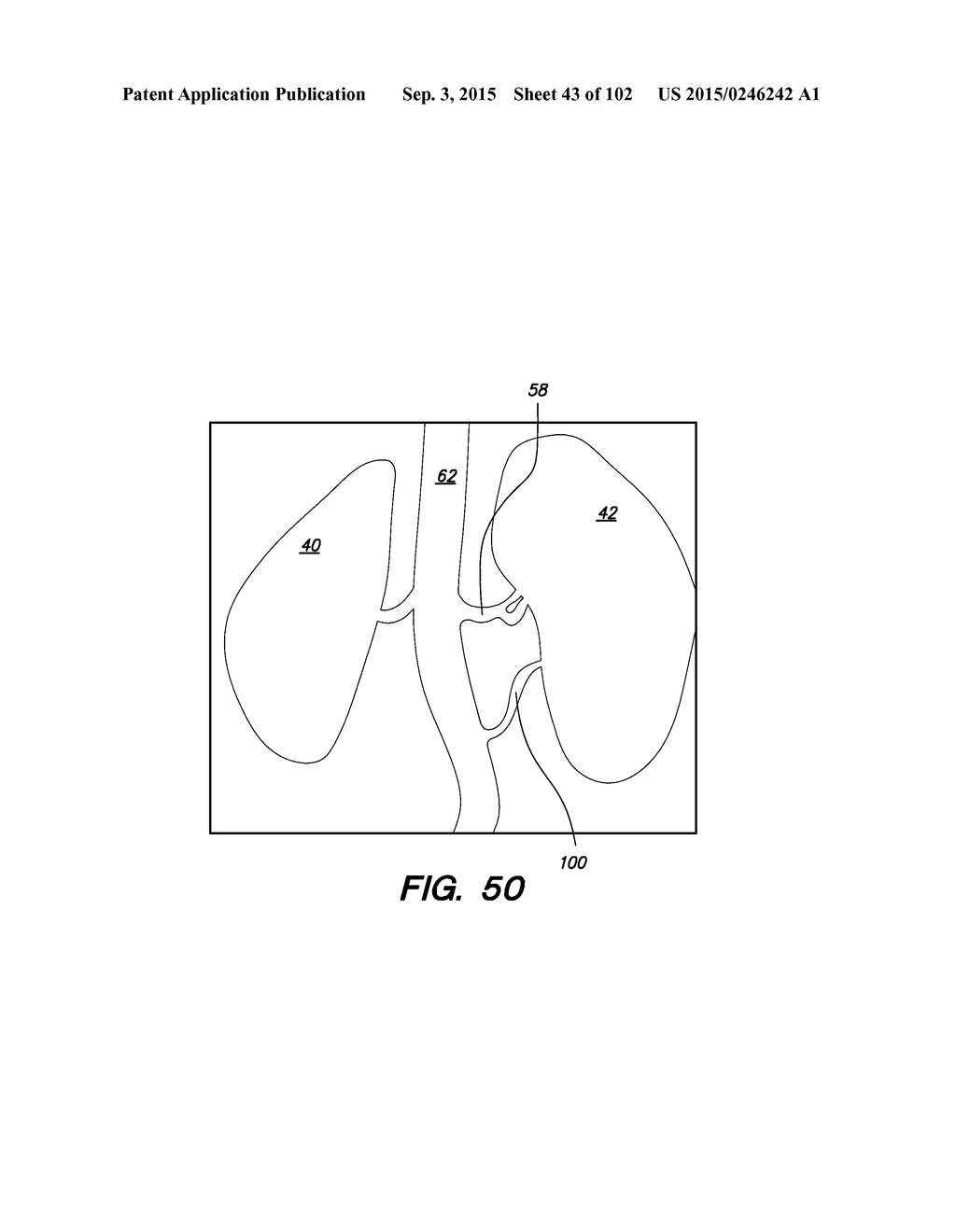 SYSTEM AND METHOD FOR OPTOGENETIC THERAPY - diagram, schematic, and image 44