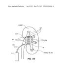 SYSTEM AND METHOD FOR OPTOGENETIC THERAPY diagram and image