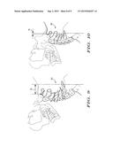 METHOD AND APPARATUS FOR IMPROVING CERVICAL CURVATURE AND FOR MAINTAINING     PROPER CURVATURE IN PERSONS PREDISPOSED TO DEVELOP IMPROPER CURVATURE diagram and image