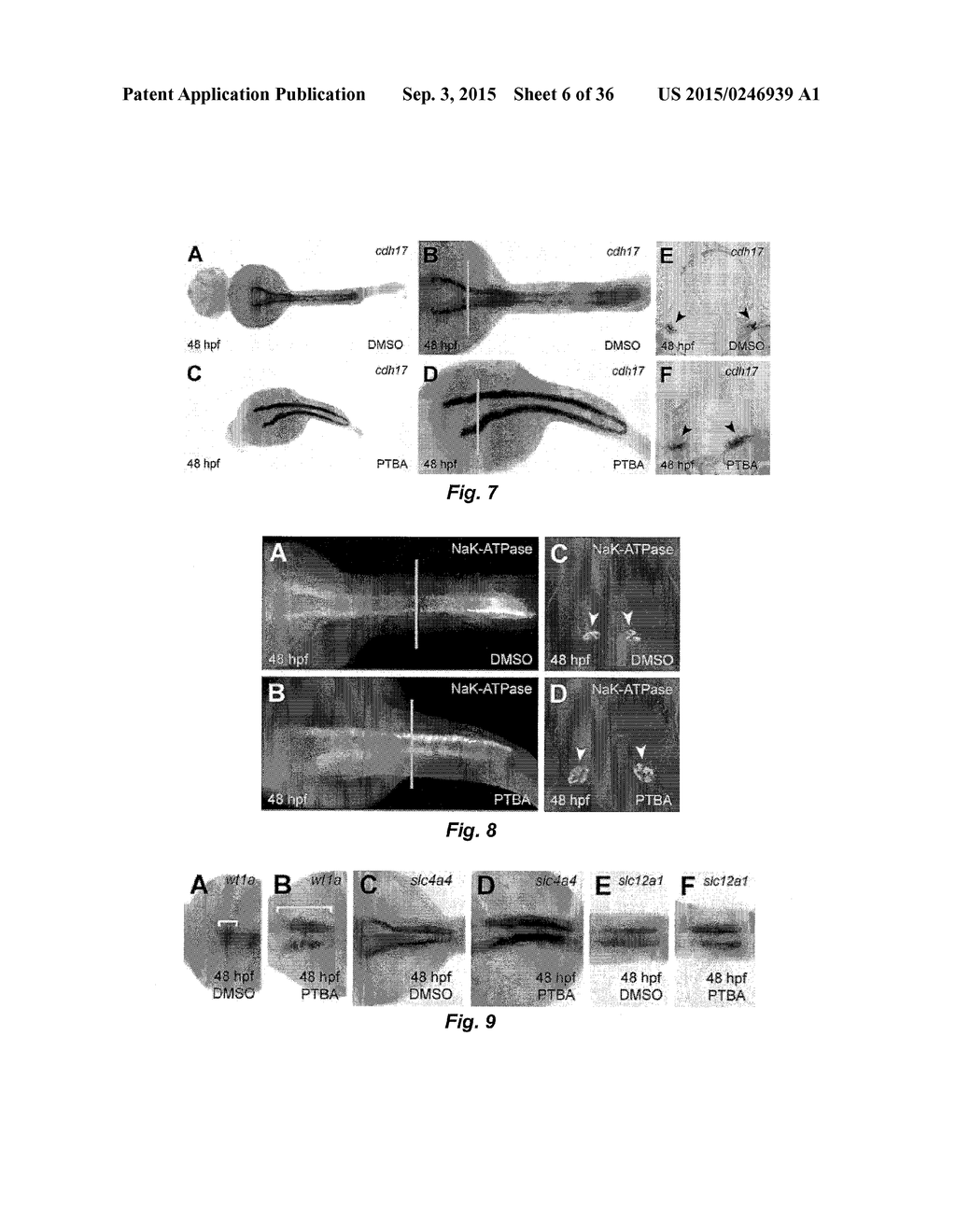 Class of HDAC Inhibitors Expands the Renal Progenitor Cells Population and     Improves the Rate of Recovery from Acute Kidney Injury - diagram, schematic, and image 07