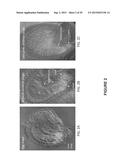 Methods and Compositions for Modulating Expression or Activity of a RKD     Polypeptide in a Plant diagram and image