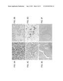 DIFFERENTIAL DIAGNOSIS OF HEPATIC NEOPLASMS diagram and image