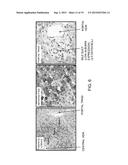 DIFFERENTIAL DIAGNOSIS OF HEPATIC NEOPLASMS diagram and image