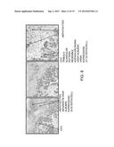 DIFFERENTIAL DIAGNOSIS OF HEPATIC NEOPLASMS diagram and image