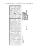 DIFFERENTIAL DIAGNOSIS OF HEPATIC NEOPLASMS diagram and image