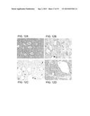 DIFFERENTIAL DIAGNOSIS OF HEPATIC NEOPLASMS diagram and image