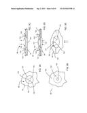 VENT STRUCTURE FOR TENSIONER diagram and image