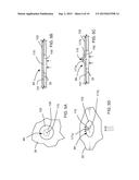 VENT STRUCTURE FOR TENSIONER diagram and image