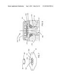 VENT STRUCTURE FOR TENSIONER diagram and image