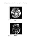 SYSTEM AND METHOD FOR ESTIMATING A QUANTITY OF INTEREST IN A KINEMATIC     SYSTEM BY CONTRAST AGENT TOMOGRAPHY diagram and image