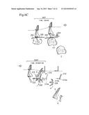 DEVICE AND METHOD FOR DEBONING BONE-IN LEG diagram and image