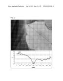 Method of Monitoring The Status of A Wound diagram and image