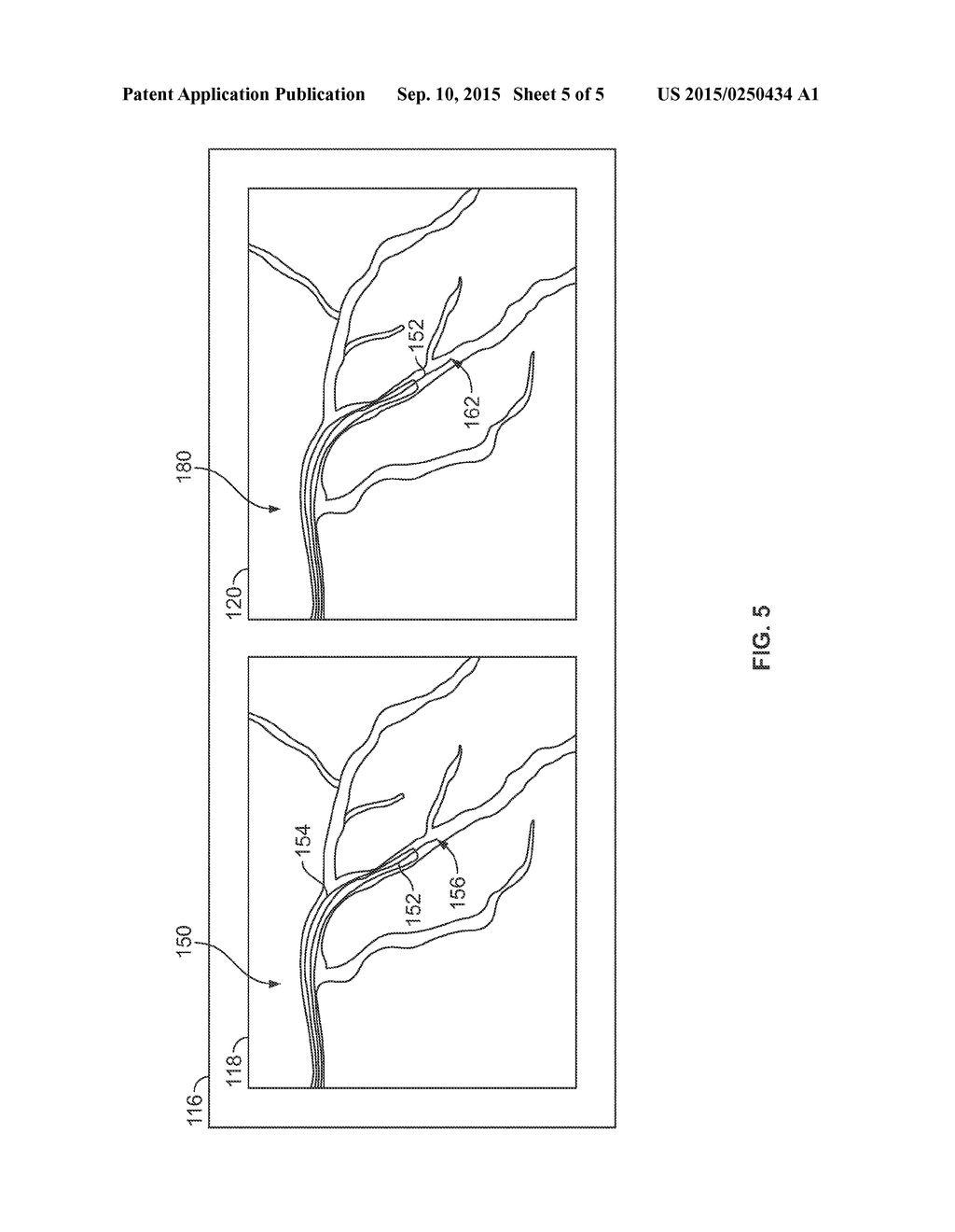 METHOD AND APPARATUS FOR CATHETER GUIDANCE USING A COMBINATION OF     ULTRASOUND AND X-RAY IMAGING - diagram, schematic, and image 06