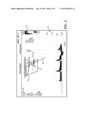 AUTOMATED BIPLANE-PW WORKFLOW FOR ULTRASONIC STENOSIS ASSESSMENT diagram and image