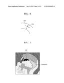 MEDICAL IMAGE PROCESSING APPARATUS AND METHOD, AND COMPUTER-READABLE     RECORDING MEDIUM diagram and image