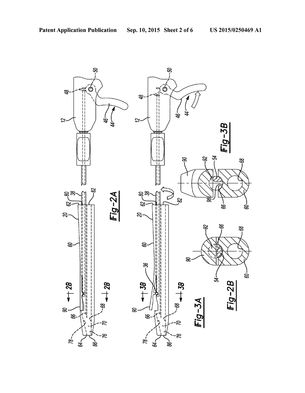 METHOD AND APPARATUS FOR COUPLING SOFT TISSUE TO BONE - diagram, schematic, and image 03