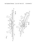 SUTURE ANCHORING SYSTEM AND DELIVERY METHOD diagram and image