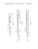 SUTURE ANCHORING SYSTEM AND DELIVERY METHOD diagram and image