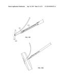 SUTURE ANCHORING SYSTEM AND DELIVERY METHOD diagram and image