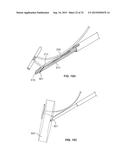 SUTURE ANCHORING SYSTEM AND DELIVERY METHOD diagram and image