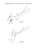 SUTURE ANCHORING SYSTEM AND DELIVERY METHOD diagram and image