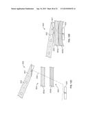 SUTURE ANCHORING SYSTEM AND DELIVERY METHOD diagram and image