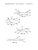 ALL-SUTURE SUTURE ANCHOR SYSTEMS AND METHODS diagram and image