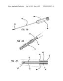 ALL-SUTURE SUTURE ANCHOR SYSTEMS AND METHODS diagram and image