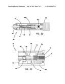 ALL-SUTURE SUTURE ANCHOR SYSTEMS AND METHODS diagram and image