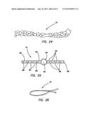 ALL-SUTURE SUTURE ANCHOR SYSTEMS AND METHODS diagram and image