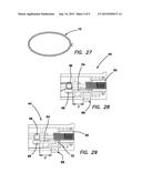 ALL-SUTURE SUTURE ANCHOR SYSTEMS AND METHODS diagram and image