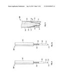 SUTURE ANCHOR diagram and image